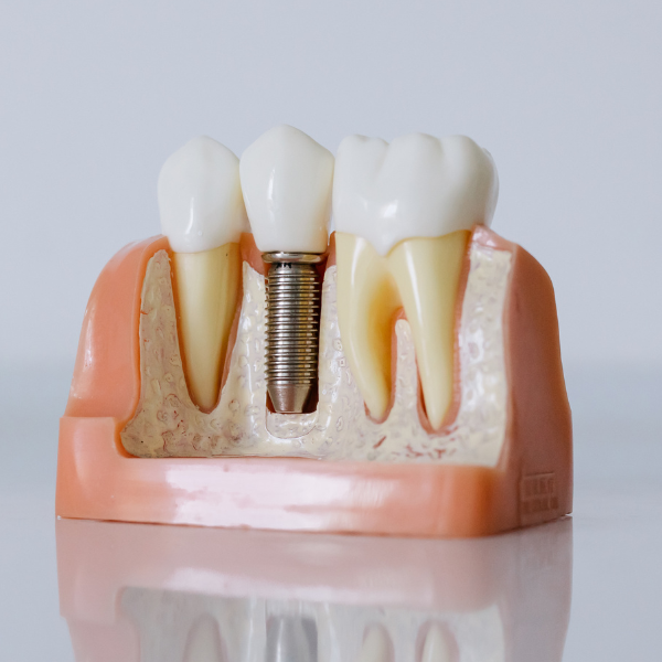 Mantenimiento web clínica dental Yeyo Molina 2 Mantenimiento web clínica dental Yeyo Molina 2