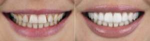 Diseño Web para Dentistas y Clínicas Dentales: Atrae más Pacientes. Yeyo Molina